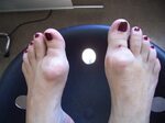 Feet Faculty of Medicine